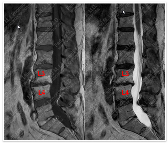 Case 1 Image 2