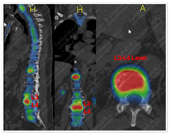 Case 1 Image 3