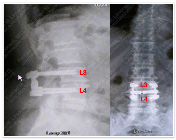 Case 1 Image 4