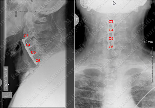 Case 1 Image 5