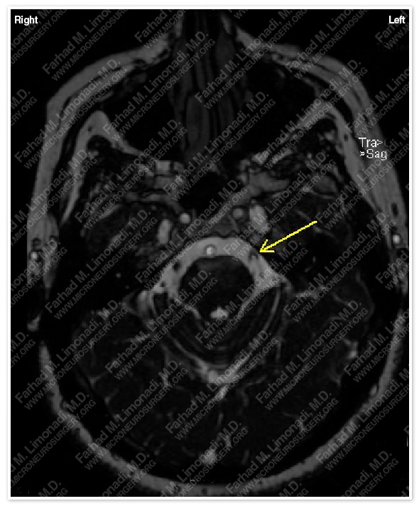 Case 1 Image 1