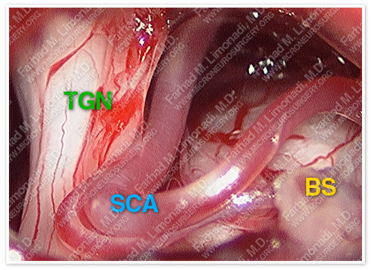 Case 1 Image 5