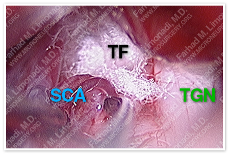 Case 2 Image 4