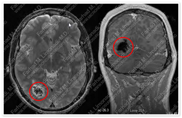 Case 1 Image 1