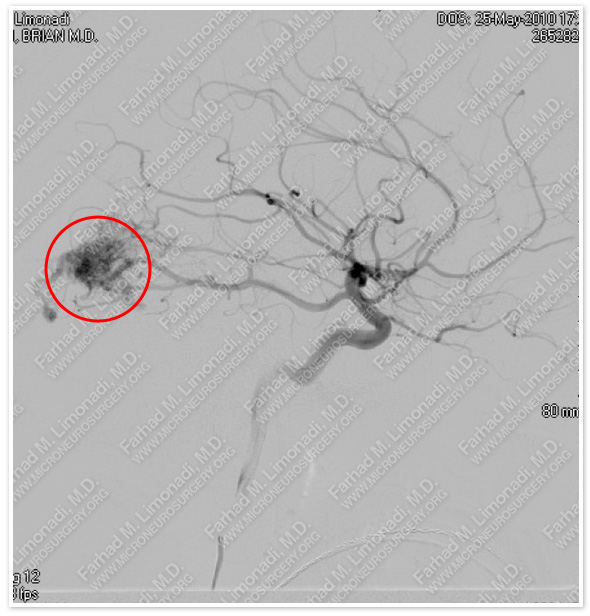 Case 1 Image 2