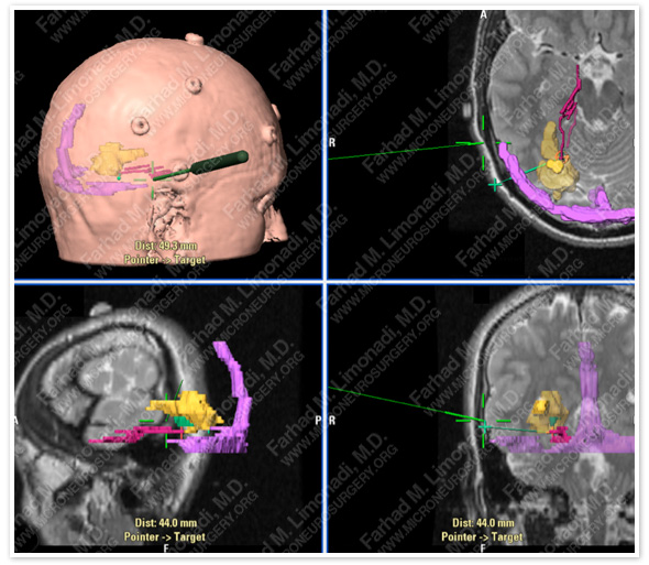 Case 1 Image 3