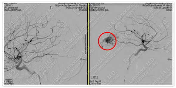 Case 1 Image 5