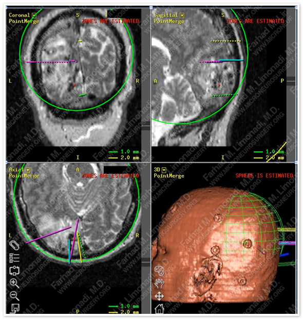 Case 2 Image 5