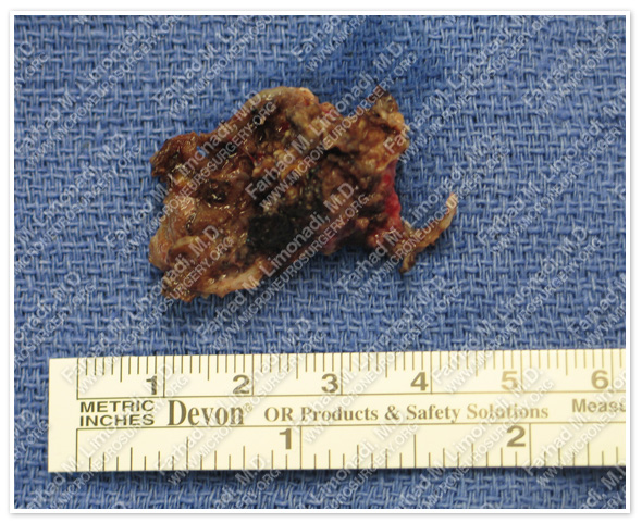 Case 2 Image 7