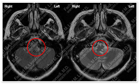 Case 1 Image 1