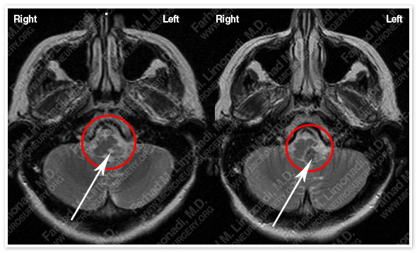 Case 1 Image 2