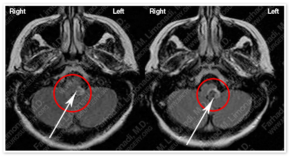 Case 1 Image 3