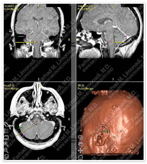 Case 1 Image 5