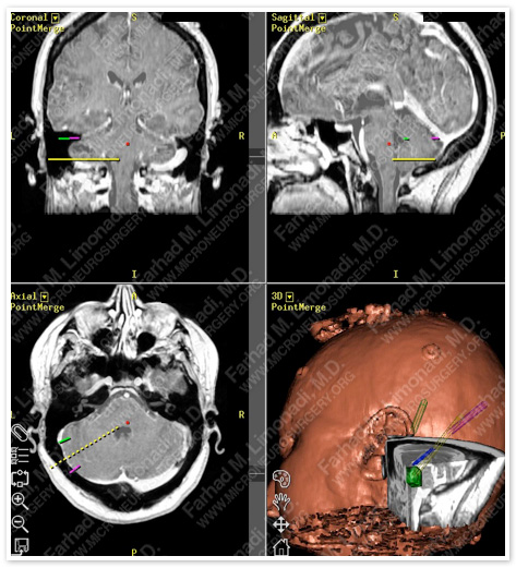 Case 1 Image 6