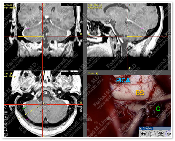 Case 1 Image 8