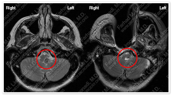 Case 1 Image 10